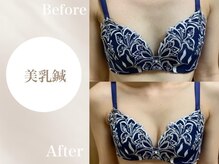 Onはり灸サロン/バストUP美乳鍼before→after