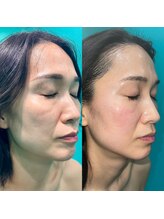 ヴィヴ 熊本(ViV)/お悩みに合わせてカスタム！！