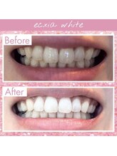 エクシアホワイト 長野店/