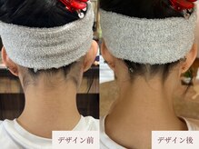 クラームビューティー(Clerm beauty)/美容師によるうなじデザイン脱毛