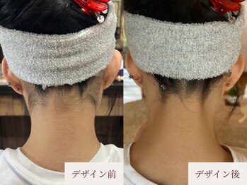 クラームビューティー(Clerm beauty)/美容師によるうなじデザイン脱毛