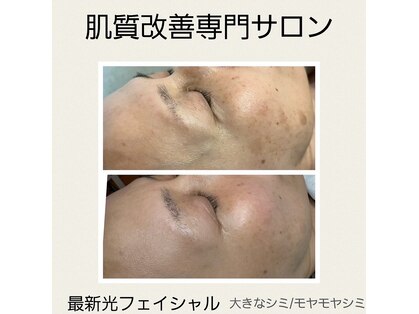 エスボーテ(sbeaute)の写真