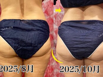 ラブ美長寿 沖縄本店(Lab)/【美肌痩身】下半身痩身コース