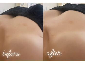 エムプリュ 心斎橋店(M.plus)/バストアップコース1回目