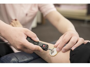 寺倉ハピネス接骨院/ハイボルテージ施術(スネ)