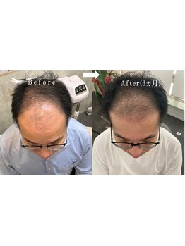 完全個室のリラクゼーションサロン