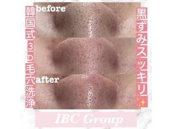 トータルサロンアイビーシー(トータルサロンIBC)/大人気! 毛穴洗浄