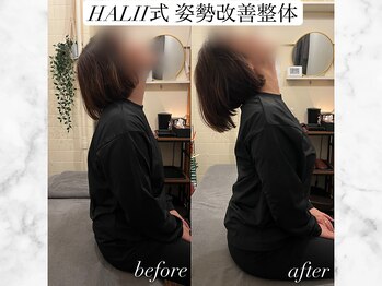 ハリートウキョウ 整体院 南青山院(HALII TOKYO)/姿勢から首肩こり改善【肩こり】
