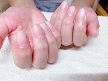自爪風ネイル