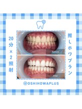 ベルプラス 新大阪(Belle plus)/推しホワプラスホワイトニング