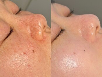 ルーナジェーナ(Luna llena)/池袋　エステ　ルーナジェーナ