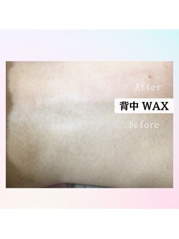 メルベスワックス(MELVES WAX)/背中ワックス脱毛