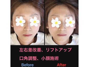 美容矯正サロン レレポノ(LELEPONO)/