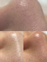 フェリス(FELIZ)/フェイシャルNo.１