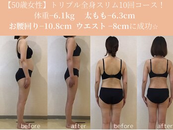 エターナルフレーム(Eternal Flame)/50歳全身スリム10回コース