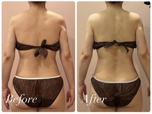 エール 恵比寿店(AILES)/贅沢ブライダルSET!トータルケア