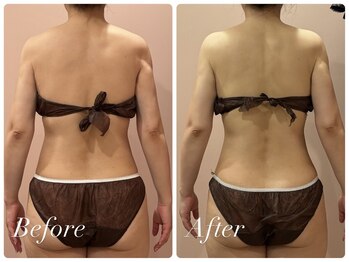 エール 恵比寿店(AILES)/贅沢ブライダルSET!トータルケア