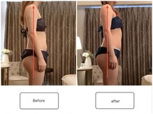 スラン(Slan)/巻き肩改善