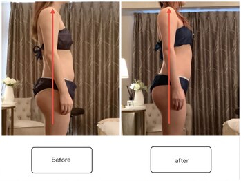 スラン(Slan)/巻き肩改善