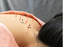 鍼按堂の雰囲気(お悩みをなんでもご相談ください。)