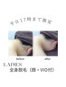 ☆限定☆【平日17時まで】産毛も無くせる♪全身脱毛〈顔・VIO付〉