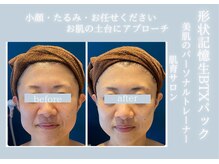 モルティー 宇都宮店(Molti)の雰囲気（広々駐車場完備♪20代～60代幅広い年齢のお客様が通われています）