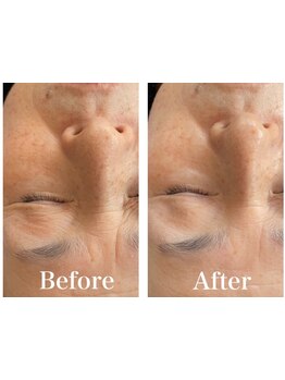 お肌をきれいにしたい