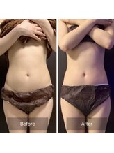 インナーメス(INNER MES)/全身コースでむくみとさよなら！