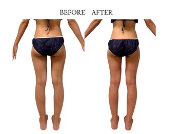 ヨサパーク サノン(YOSA PARK Sanon)/その下半身、痩せれますよ！