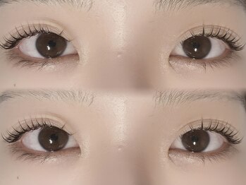 シャローム アローヴ(shalom alob)/【まぶたが重いお悩み解決に】