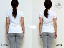 エーアール(AR)/【Before/After】　