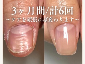 ツナミ(Tsunami)の写真/忙しいあなたに♪結果重視の爪ケア3300円！形＆甘皮ケアで美爪を叶えます☆