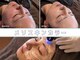 プラス ミー(+Me)の写真/SNSで話題沸騰！美容成分をダイレクトに届けながらトーンアップを叶える♪新感覚フェイシャルケア！