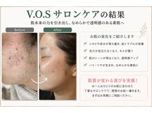 リノリー 石巻店(rinory)の雰囲気(#VOSサロンケア)