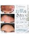 ユアーズ ビューティー(YOURS beauty)の写真/京都唯一の11種類の国産ハーブピーリングで、ニキビケアと輝く素肌へ♪★
