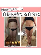 アンリール 旭川店(Anrire)/BODY施術のお客様です！