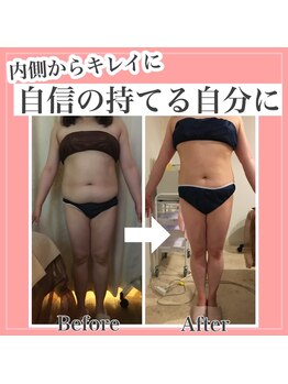 アンリール 旭川店(Anrire)/BODY施術のお客様です!