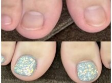 グレースレディ 大阪店/(深爪/長さだし/フィルイン)