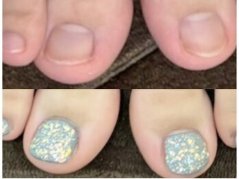 グレースレディ 大阪店/(深爪/長さだし/フィルイン)