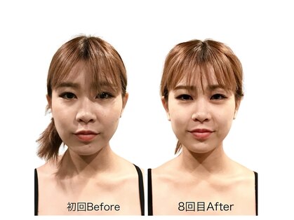 ビーホリック(Bholic)の写真