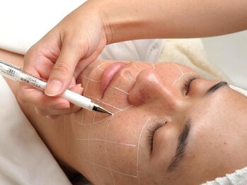 レイジア デイスパ 越谷の写真/創業22年の実績【男女OK】抜けなかった方の最終手段◎自動冷却で痛みを緩和♪お試しでも効果実感の徹底照射