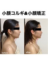 マインドプラス(mind plus)/あご下スッキリ！