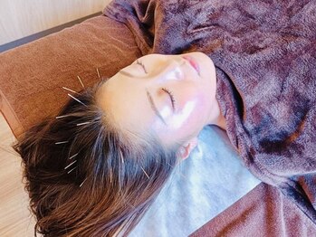 谷町はら鍼灸整骨院の写真/【美髪鍼35分¥5300】抜け毛予防/ボリュームアップ/ツヤのある髪/お顔のたるみ改善・リフトアップへ効果的◎