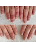 【本気の美爪育成】コンプレックスを卒業！３ヶ月全８回コース￥68,000