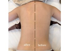 リコット(Licott)/before after写真