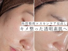 ユウビジン(YOU美人)/