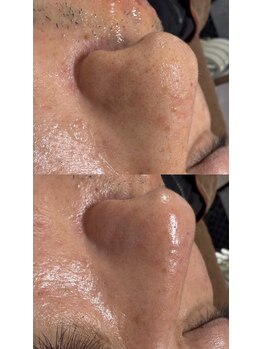 フォビィサロン(FOBE...salon)/ビオフィート