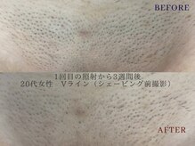 リッセ(Lisse)の雰囲気(男性から女性キッズまで!脱毛ならLisseにお任せください!)