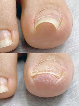 牛久巻き爪センターの写真/豊富な専門知識を持つ補正士が、あなたの巻き爪に的確なアドバイス！スペシャリストにお任せ下さい◎