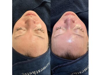 エスポワールカルド(Espoir caldo)の写真/ナノチップ導入で新次元の肌質改善へ！うるおう美肌ツヤ弾力ハリが続く★